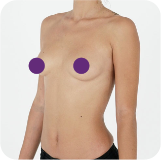 Breast photo demonstration