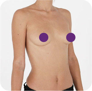 Breast photo demonstration