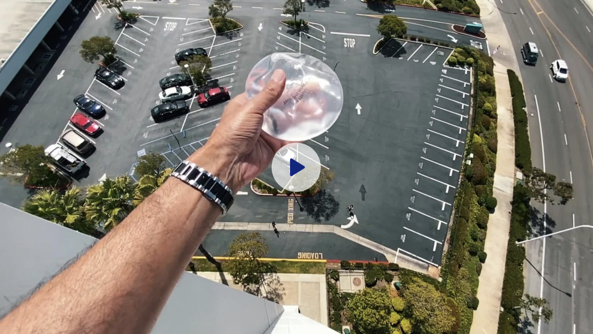 Dr. Grover holding breast implant over balcony