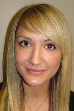 Non Surgical Rhinoplasty Before and After | Grover Aesthetics